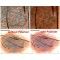 DermaScope® Polarizer HR 200x (MEDL7DM)